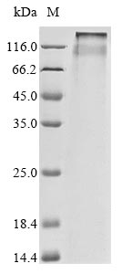 Human CLCN3 protein