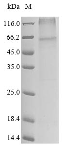 Human ADRB1 protein