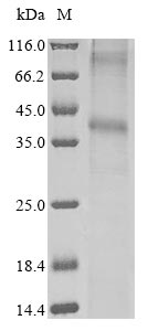 Human GPRC5D protein