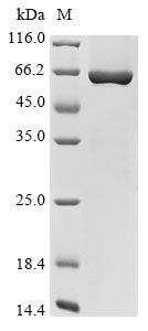 Human CCDC112 protein