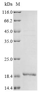 Influenza A virus Matrix protein 2 protein