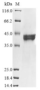 E. coli aroH protein