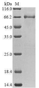 Rat Etfdh protein
