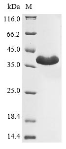Legionella pneumophila Zinc metalloproteinase protein