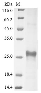 Human TMEM219 protein