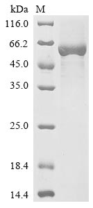 Human SERPINC1 protein