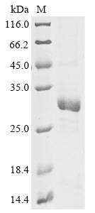 Chlamydia trachomatis Virulence plasmid protein pGP3-D protein