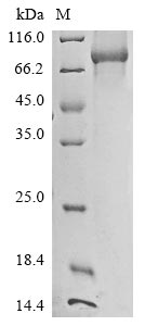 Human Lanosterol synthase(LSS) protein