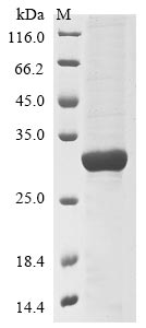 Human PARP9 protein