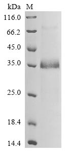 Human NOTCH2NLB protein