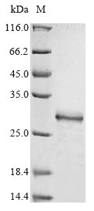 Schistosoma mansoni Antigenic integral membrane glycoprotein protein