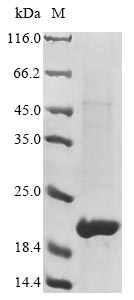 Pisum sativum Leghemoglobin Lb120-8 protein