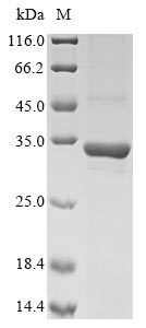 ppk2 protein