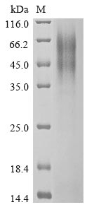 betacoronavirus 2c EMC/2012 Spike glycoprotein protein