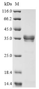metapneumovirus Matrix protein protein