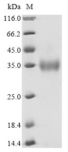 betacoronavirus 2c EMC/2012 Spike glycoprotein protein