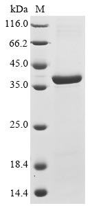 Mouse Ptprs protein