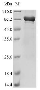 Human CCDC112 protein