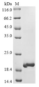 Influenza A virus Matrix protein 1 protein