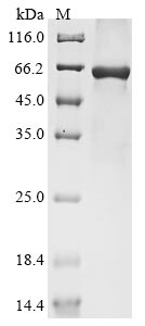 Influenza A virus Hemagglutinin protein