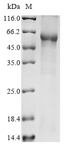 Human ZC3H7B protein