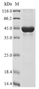 Human KMT2E protein