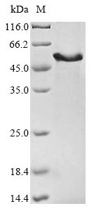 Human MEIS3 protein