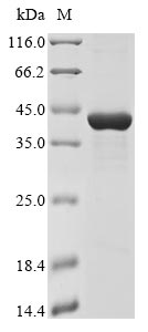 Haemophilus influenzae Immunoglobulin A1 protease autotransporter protein