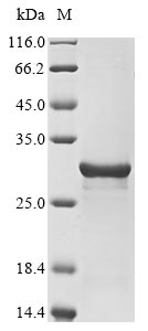 Coturnix coturnix japonica Extracellular fatty acid-binding protein protein