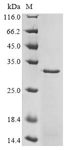 Human DRD2 protein