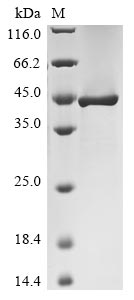 Human LGI1 protein