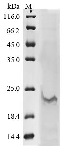 Influenza A virus Matrix protein 1 protein