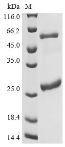 Human IARS protein
