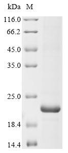 Human SCN1A protein
