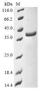 Mouse Sirt5 protein