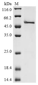 Human RNH1 protein