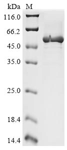 EEF1A1 protein