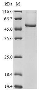 Human CRACR2B protein