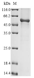 Human KRT34 protein