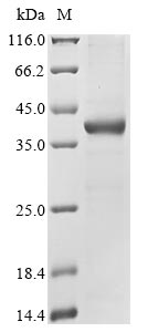 Human GPX5 protein