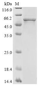 Human CYP19A1 protein