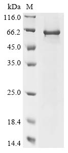 Human CHMP7 protein