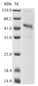 Ross river virus Structural polyprotein protein