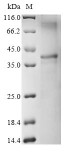 Tetranychus urticae Uncharacterized protein
