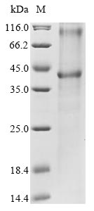Human UGCG protein
