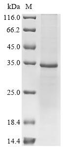 Rabbit GHR protein