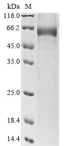 Rat Sost protein