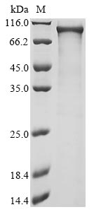 Human ATF7IP2 protein
