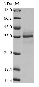 Mouse Sirt5 protein