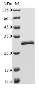 Human COMMD5 protein
